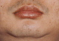 面相分析:9、下停─口与下巴