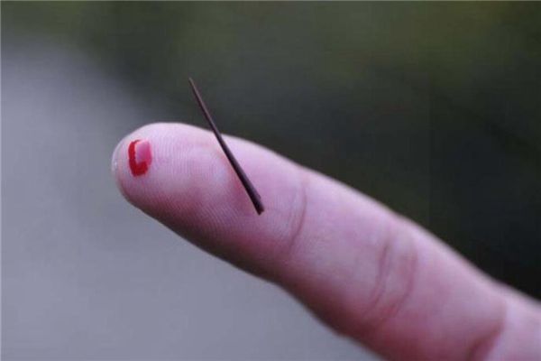 梦见手指被扎