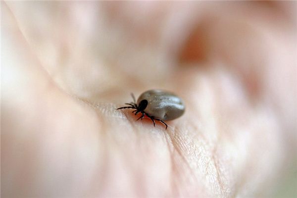 梦见寄生虫是什么意思 梦见寄生虫《梦见寄生虫钻进了身体里什么意思》 周公解梦