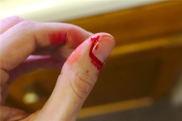 梦见手流血是什么预兆