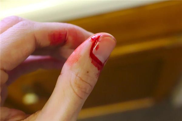 梦见被人咬手是什么意思 梦见被人咬手是什么意思