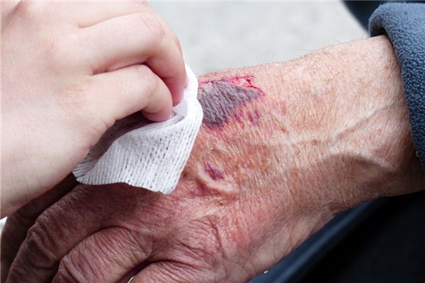 梦见左手受伤是什么意思 梦见左手受伤是什么意思