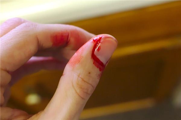 梦见亲人流血是什么意思 梦见亲人流血是什么意思