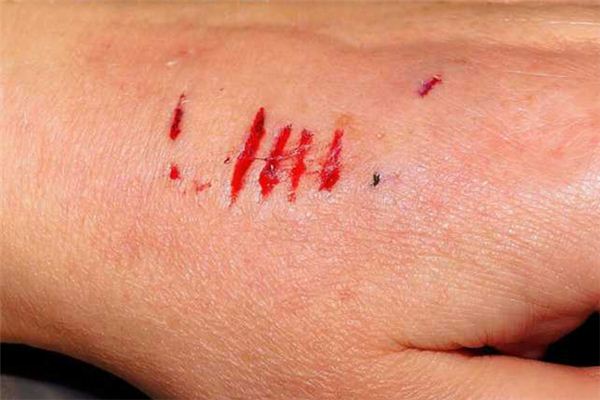 做梦被人狗咬了