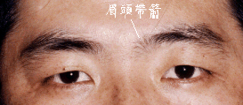眉头带箭