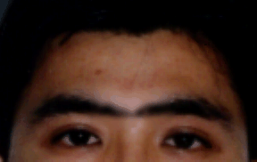 眉交连