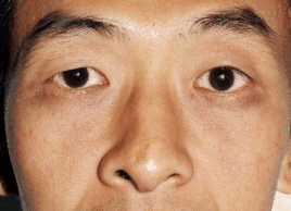 鼻不正主心术不正