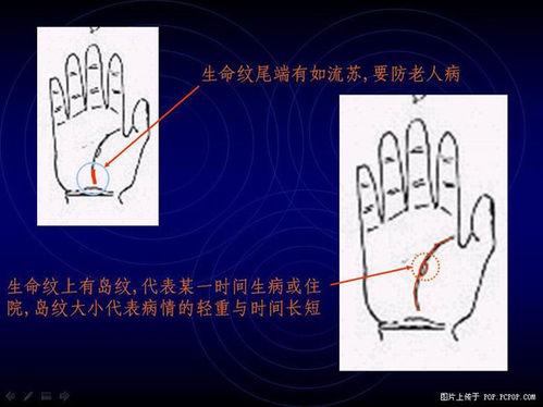 生命纹尾端有如流苏，要防老人病，生命纹上有岛纹