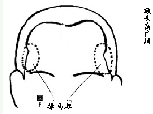 面相额头图解