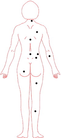 痣的位置与命运图:02、痣相吉凶速查 点痣必读要诀