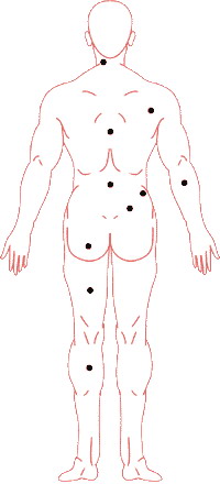 痣的位置与命运图:02、痣相吉凶速查 点痣必读要诀