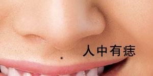痣的位置与命运图:23、这九种痣千万不能留在脸上