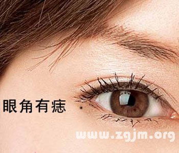 痣的位置与命运图:23、这九种痣千万不能留在脸上