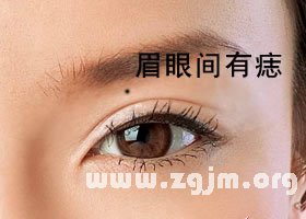 痣的位置与命运图:23、这九种痣千万不能留在脸上