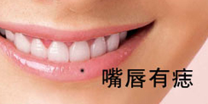 痣的位置与命运图:23、这九种痣千万不能留在脸上