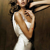 痣的位置与命运图:24、看你手臂的痣是凶还是吉