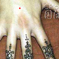 痣的位置与命运图:24、看你手臂的痣是凶还是吉