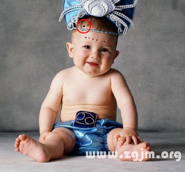 痣的位置与命运图:26、其他痣的吉凶