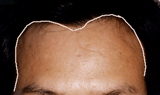 面相分析:4、上停─额