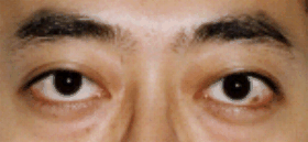 面相分析:6、中停─眼和眉