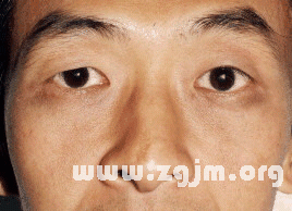 面相分析:7、中停─ 与颧