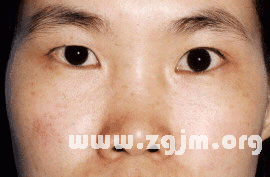 面相分析:7、中停─ 与颧