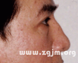 面相分析:7、中停─ 与颧