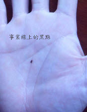事业线有黑点