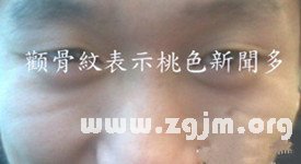 颧骨纹