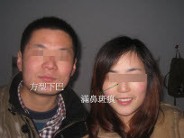 婚配男女眼下都有卧蚕
