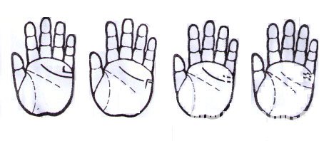 手纹学:婚姻线
