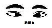 单眼外斜