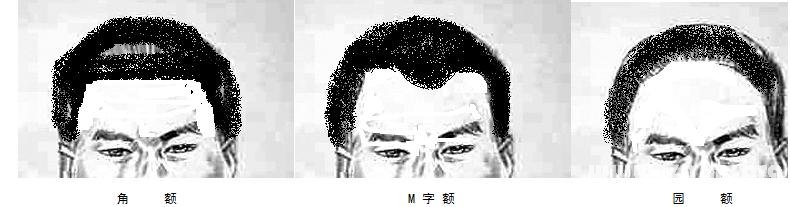 额头
