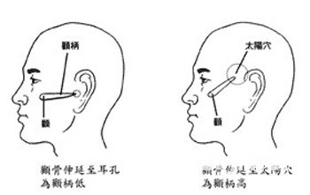 颧骨面相算命图解