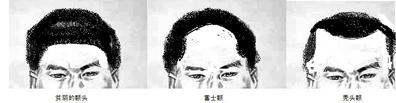 额头面相图解