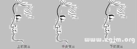突出的额头
