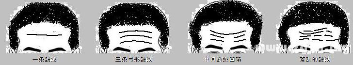 出现皱纹的额头