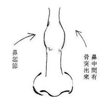 竹节鼻
