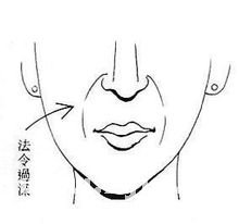 法令纹（苦泪纹）
