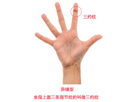 有偏财运的手相图解